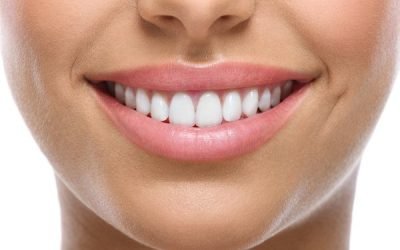 Explore Your Cosmetic Dentistry Options – Dental Veneers