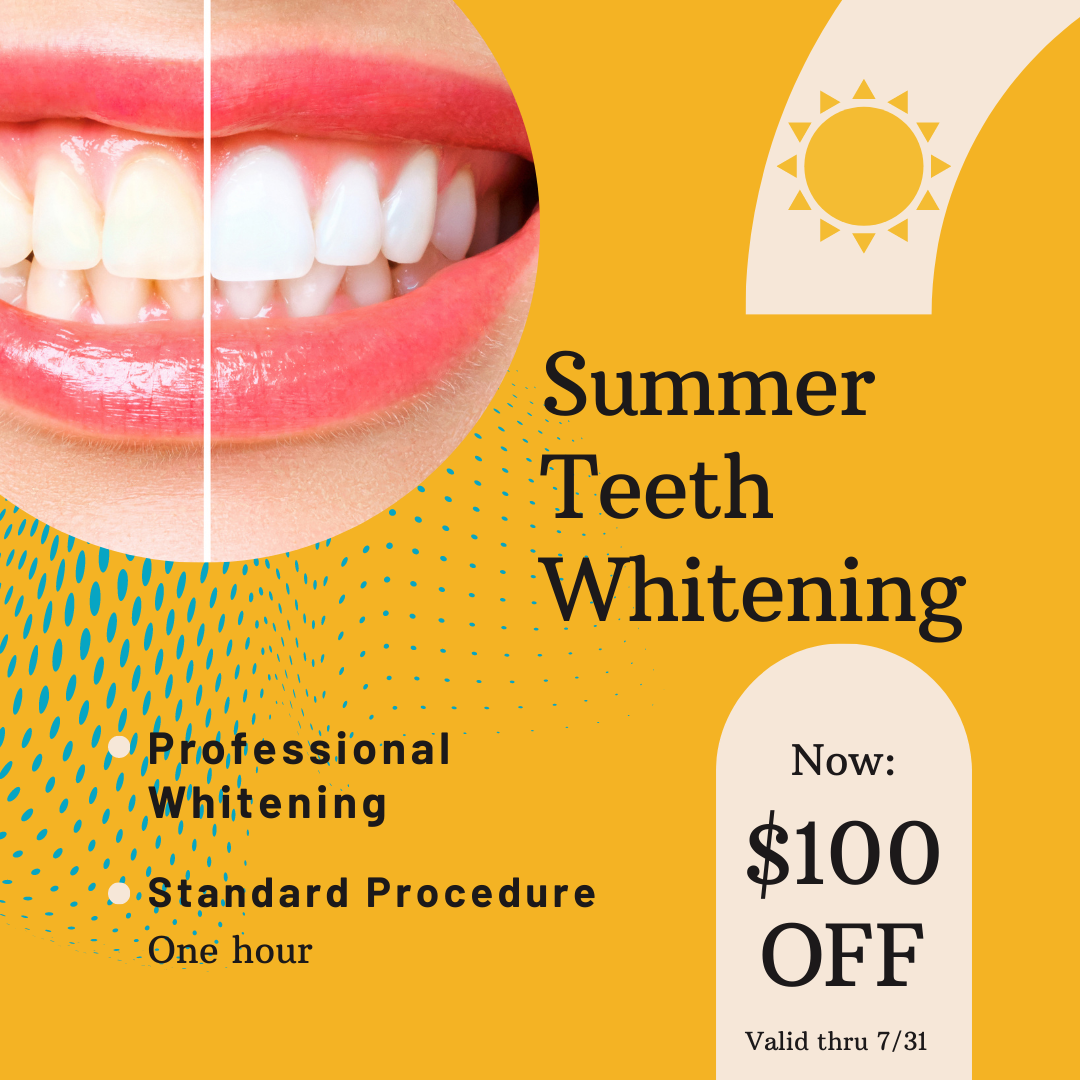 $100 off teeth whitening